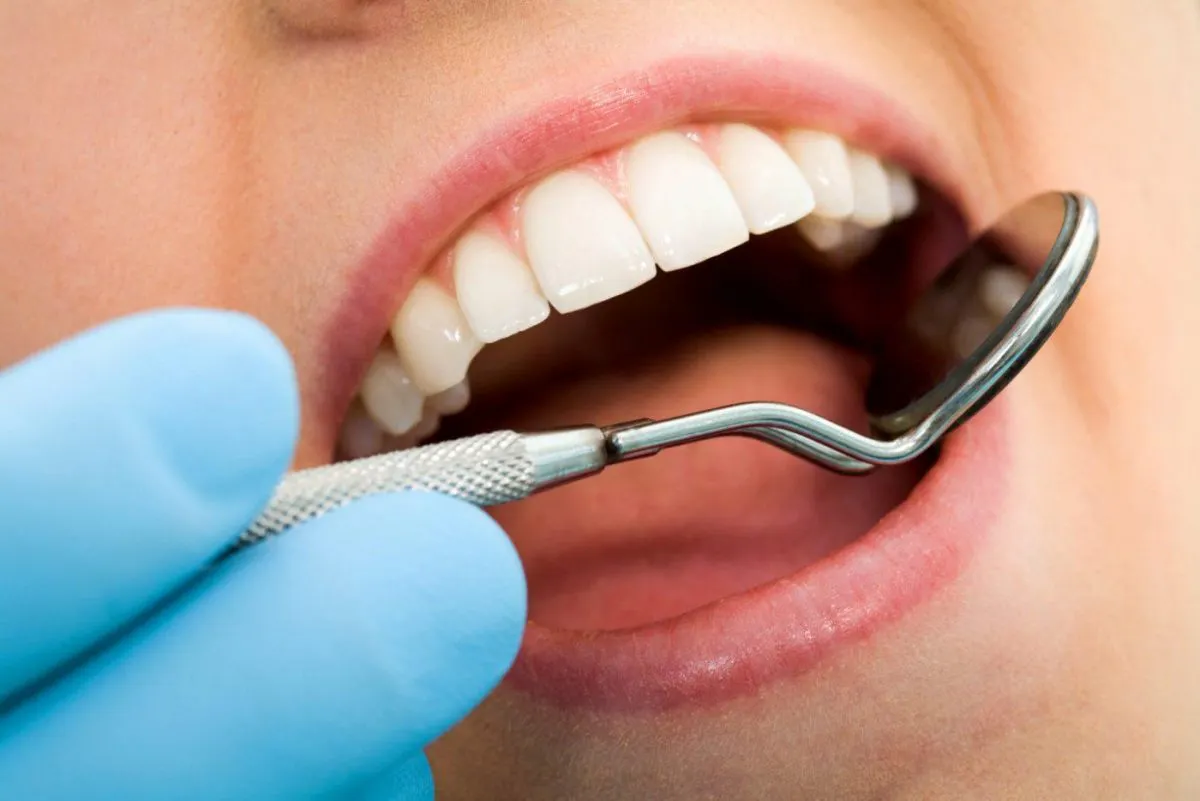Root Canal Treatment In Newcastle