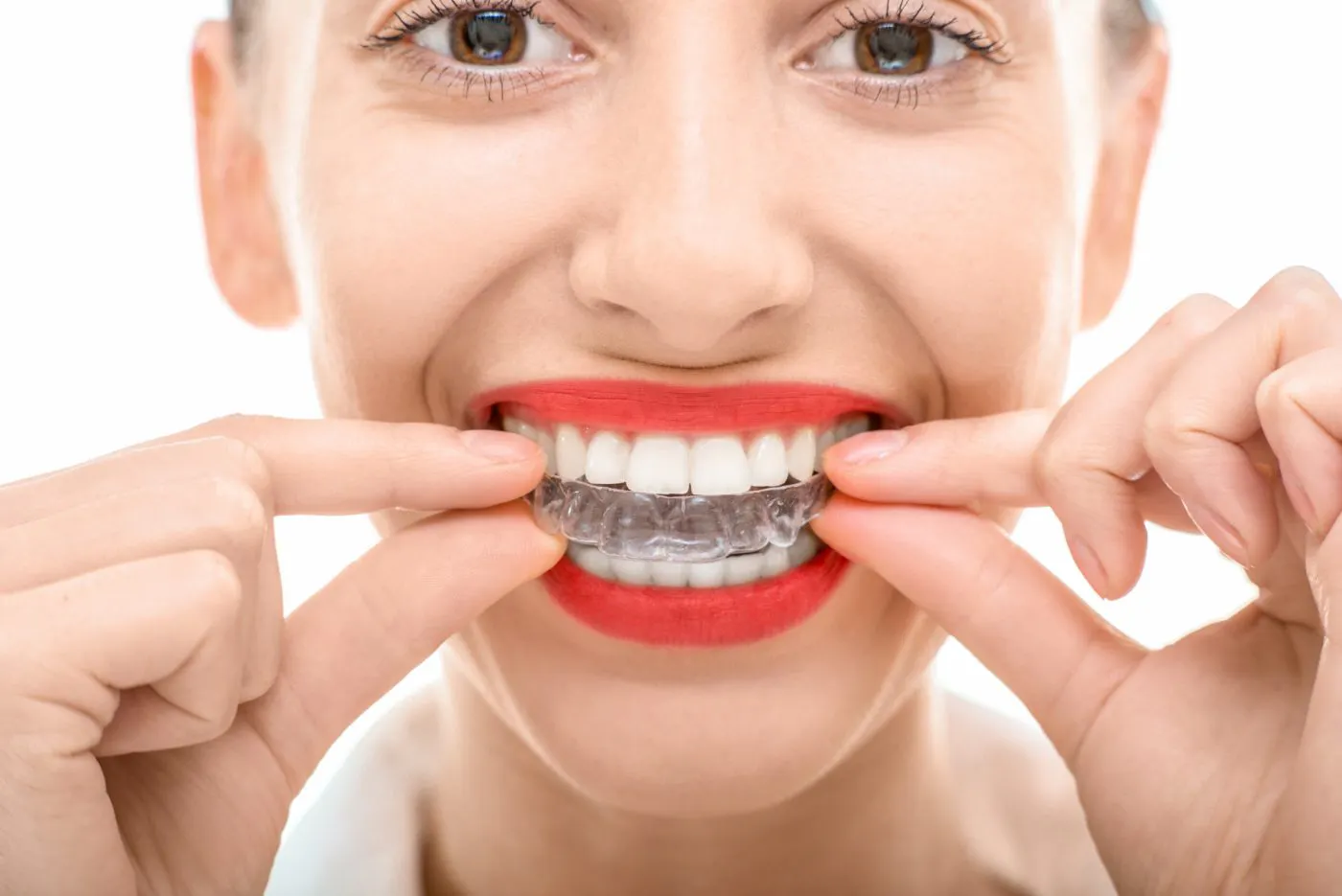 Finaghy Orthodontics Clear Aligners