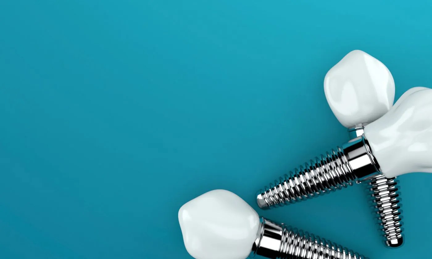 Implants Pittville Lawn Dental Implant Clinic