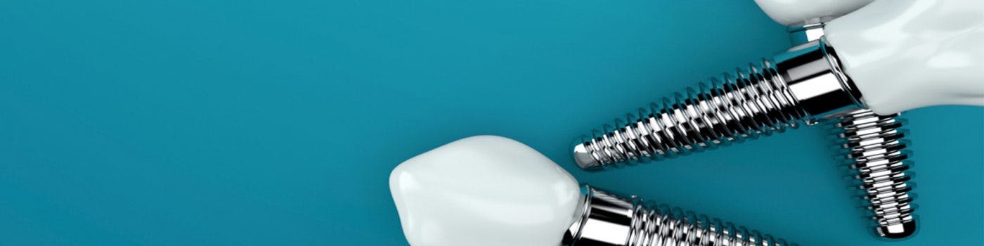 Whitby Dental Implants Hero