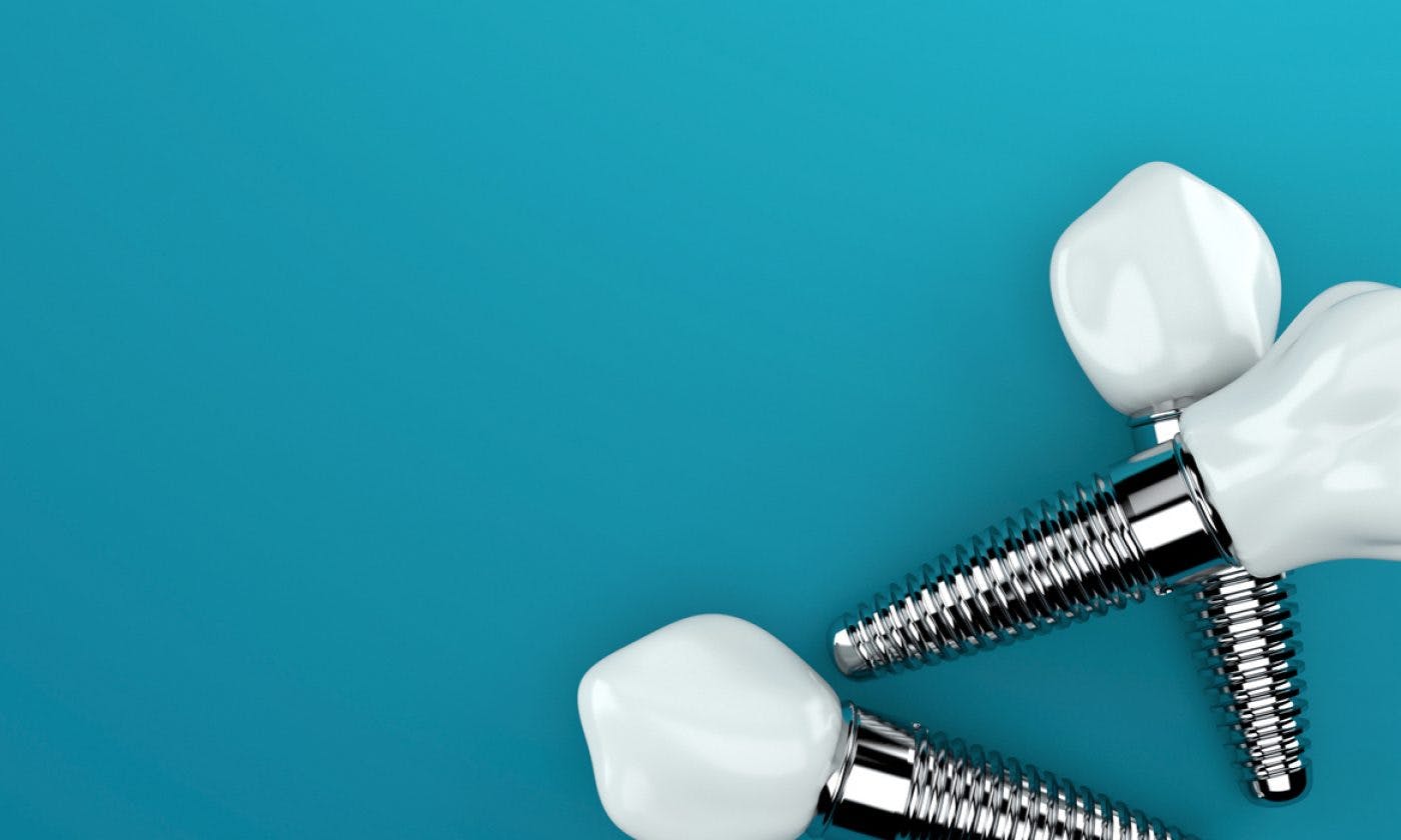 Dental Implants Courtrai House Dental Implant Clinic