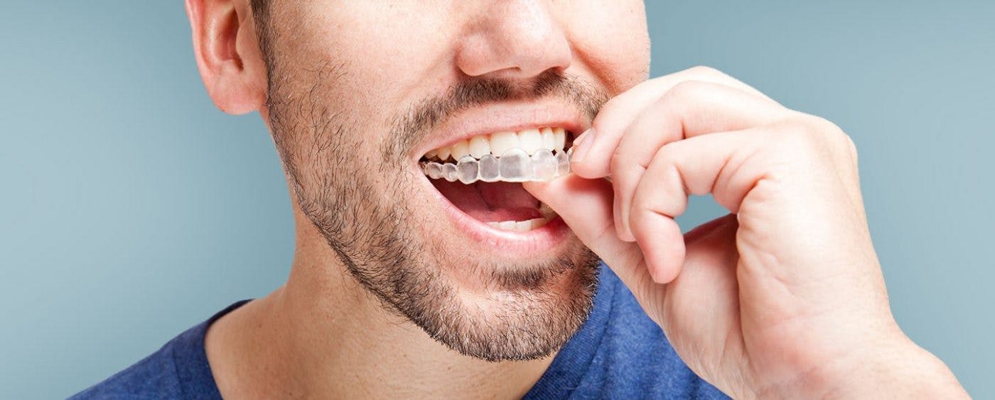 Hdic Orthodontics Invisalign