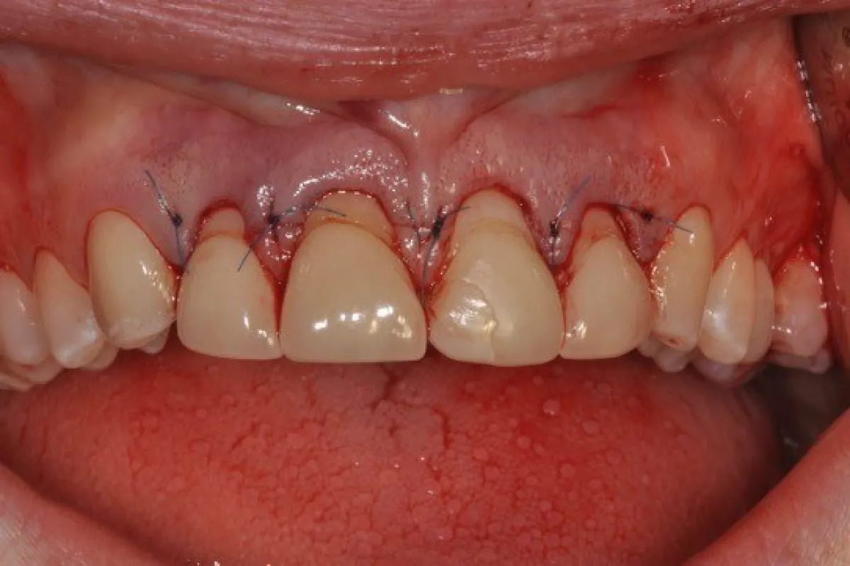 Dentist Cs22