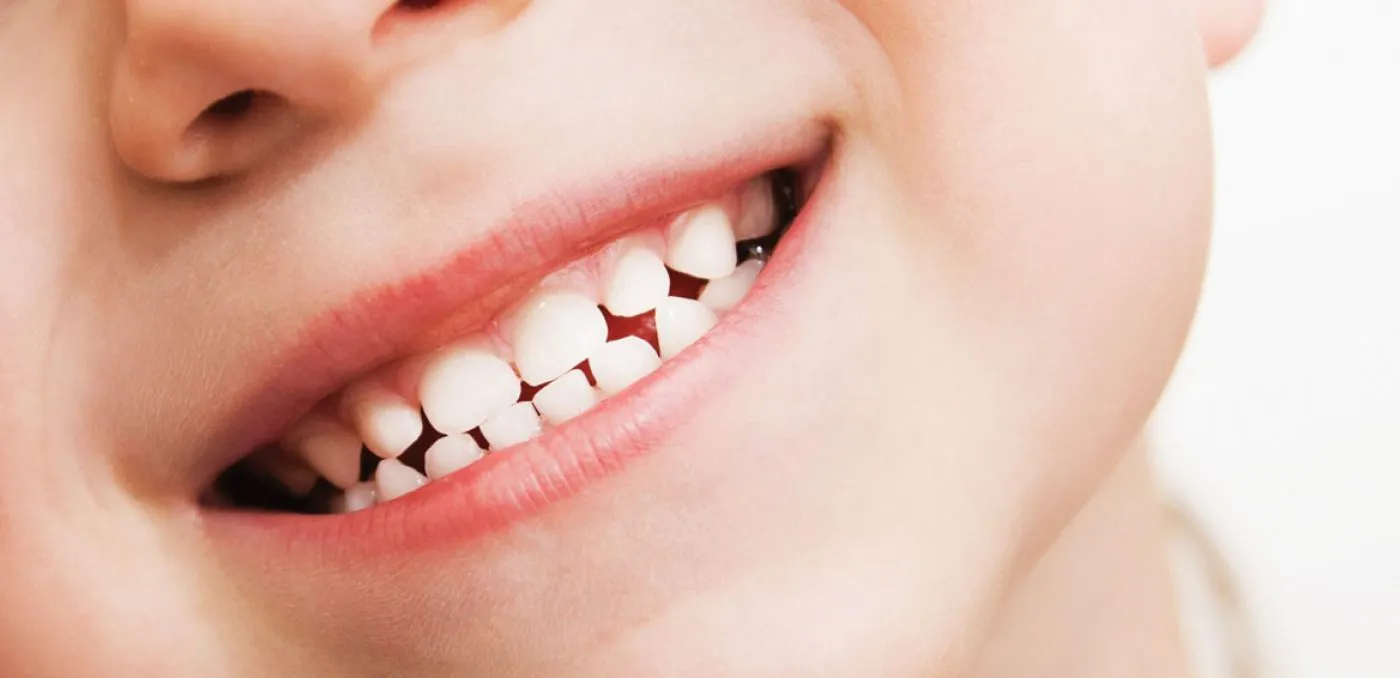 32 Whites Dental Advicecare Child