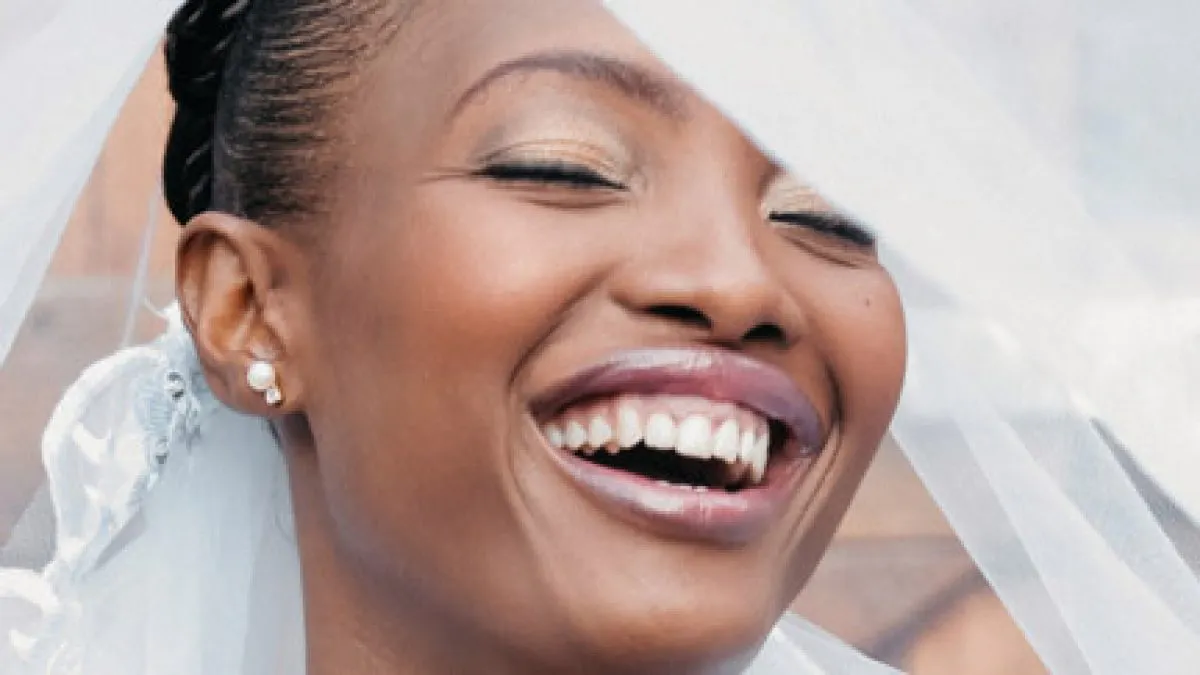 Wedding Teeth Whiteing