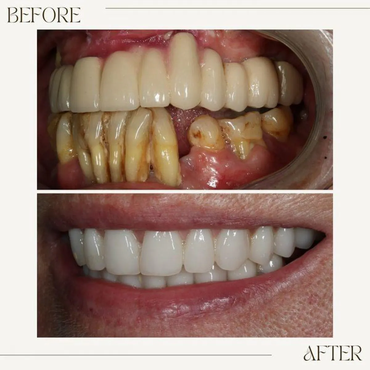 Before And After Photographs Portman Dental Care 1