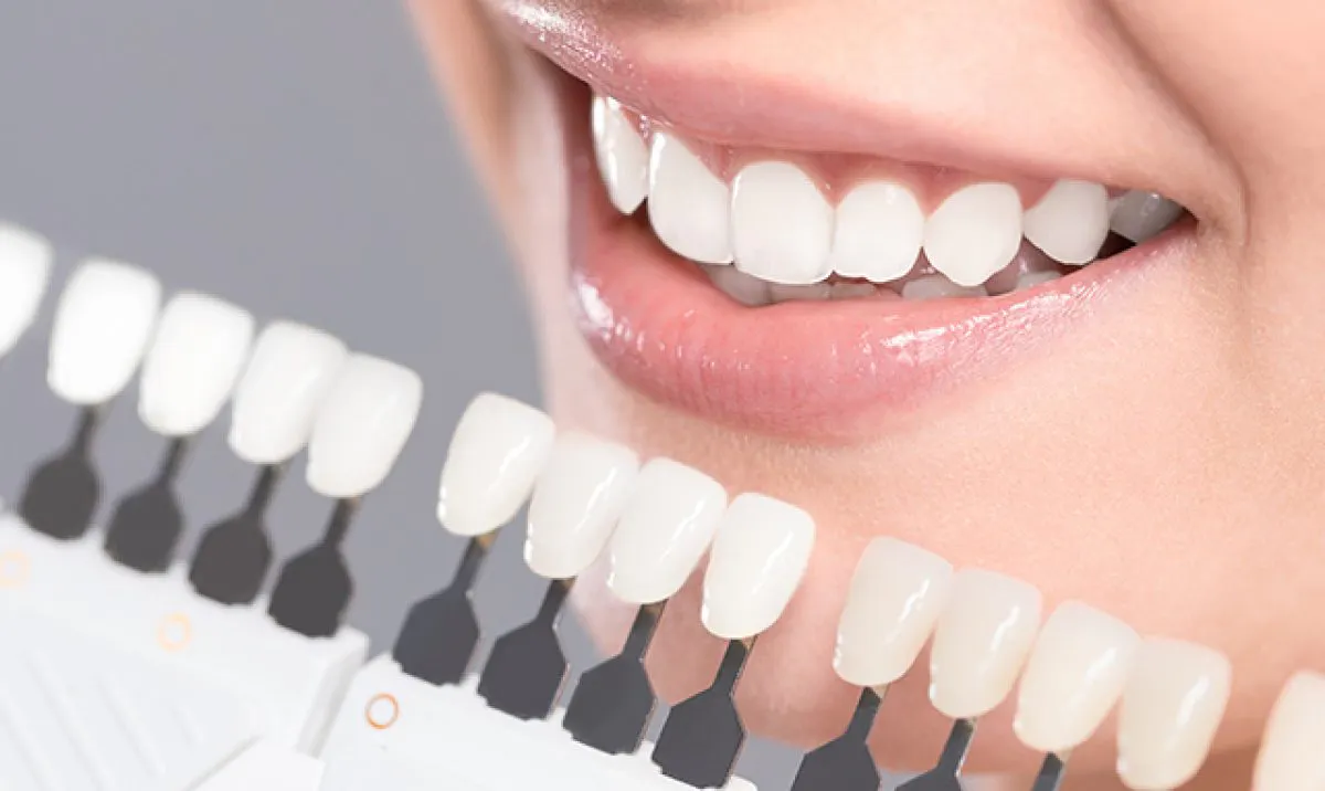 Teeth Whitening Hero Dental Academy
