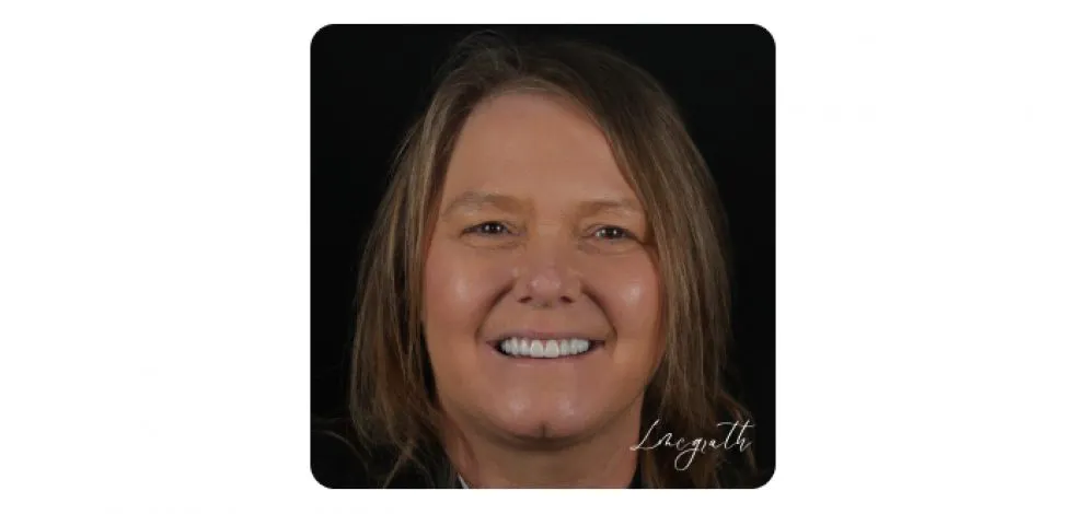 Pmcg Lmsg Complex Restorative2B