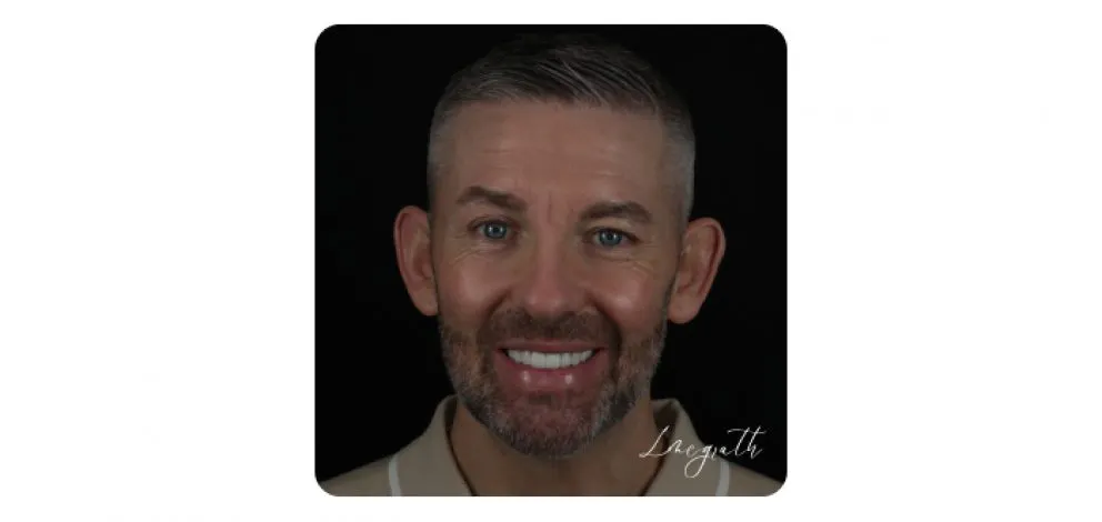 Pmcg Lmsg Complex Restorative3B