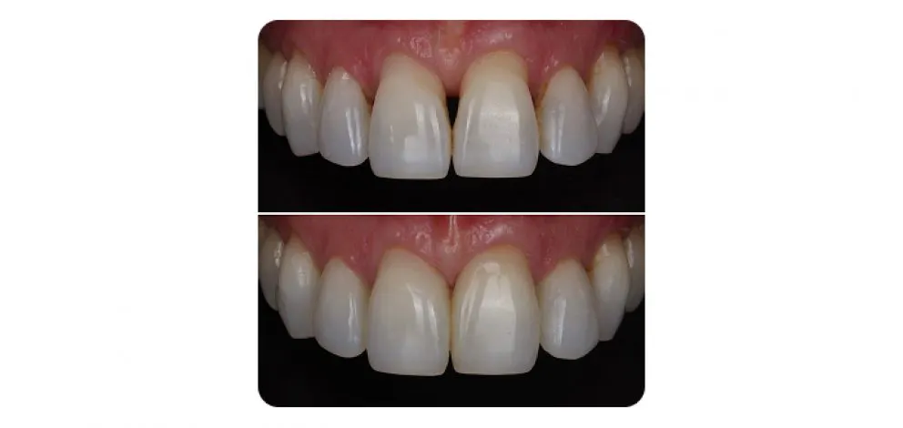 Pmcg Mpsg Comp Bond Case 1A