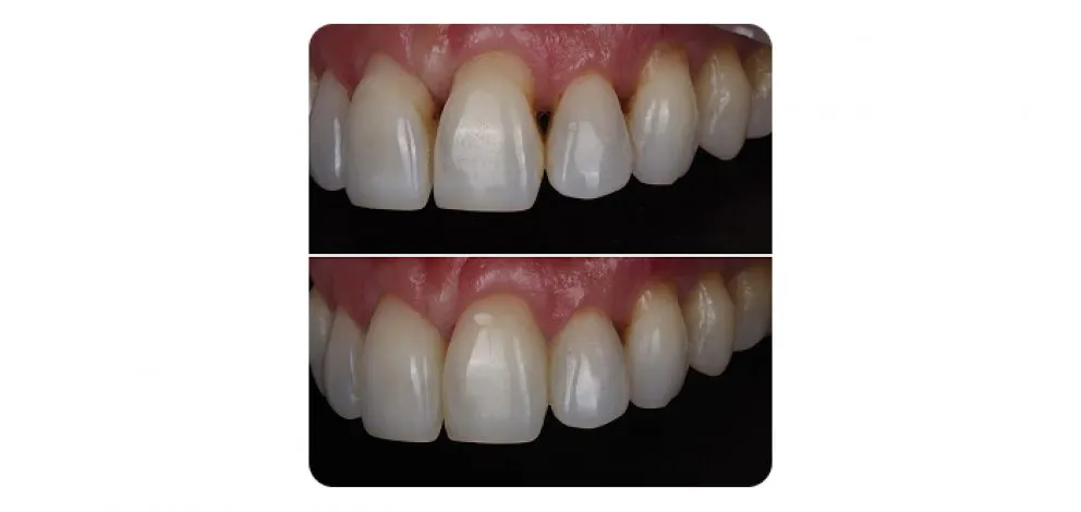 Pmcg Mpsg Comp Bond Case 1B