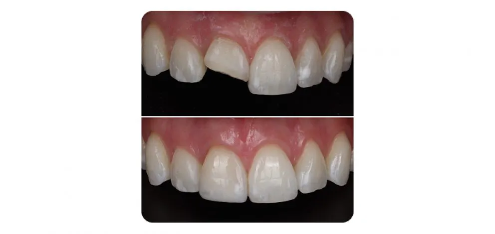 Pmcg Mpsg Comp Bond Case 2A