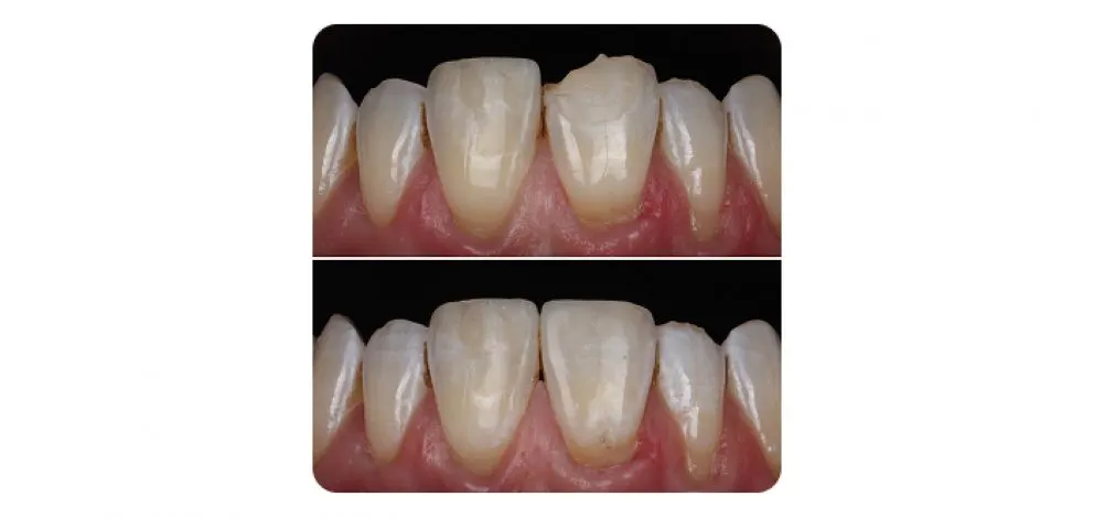 Pmcg Mpsg Comp Bond Case 2B