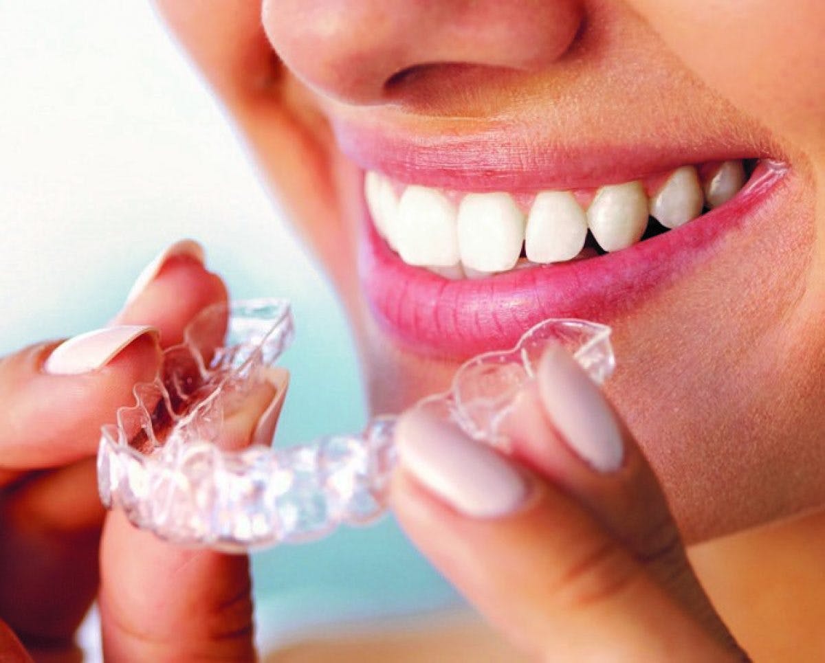 Removable Braces Cosmetic Group Page Ed