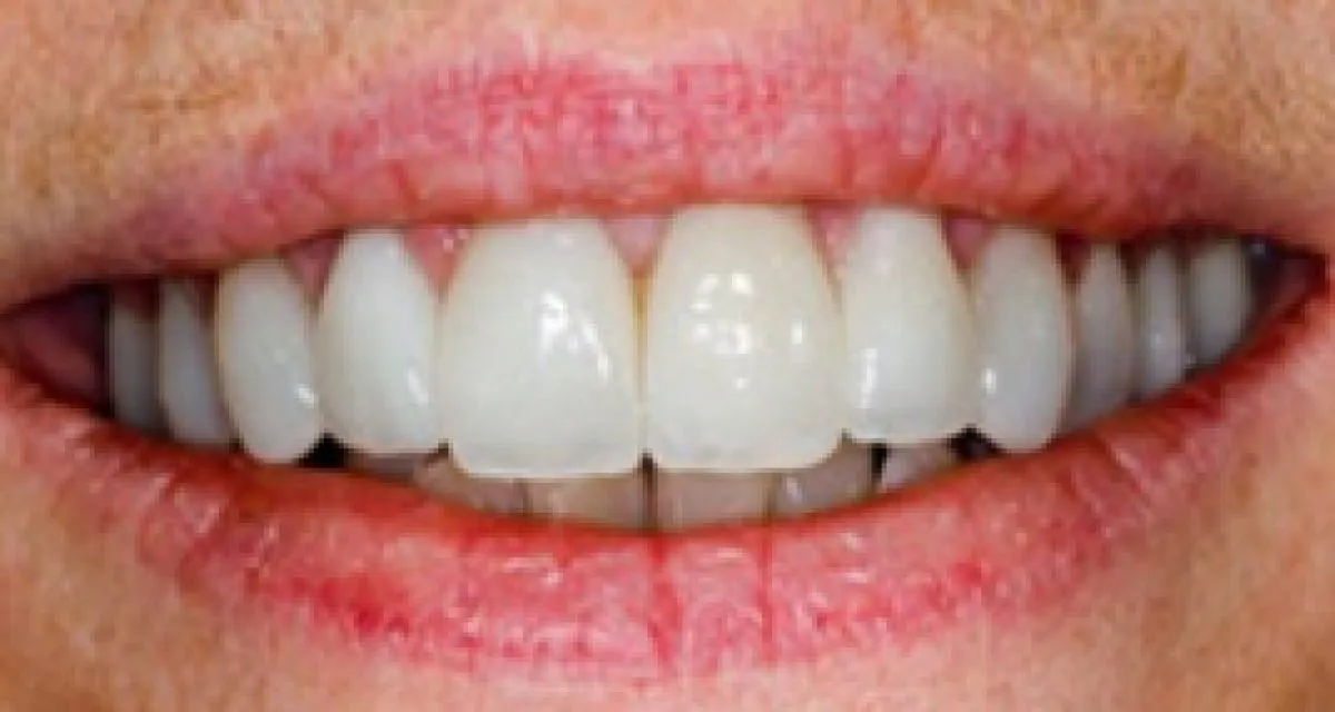 Smile gallery - South Molton | Whitehall dental practice